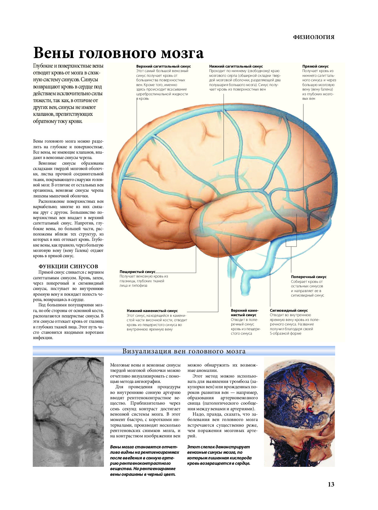 вены мозга