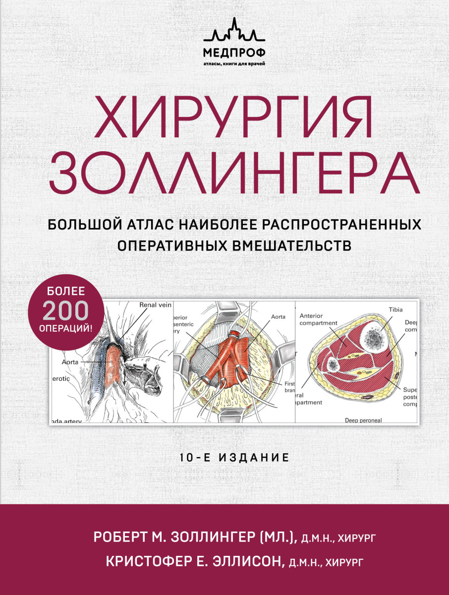 Купить Хирургия Золлингера. Большой атлас наиболее распространенных  оперативных вмешательств Золингер Р., Эллисон К. | Book24.kz